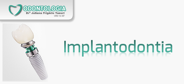 Implantodontia em Maringá